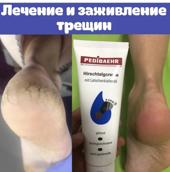 BAEHR Foot cream with natural 100% reindeer fat, 125 ml